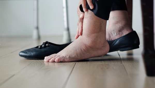 Opuchnuté nohy,aké sú príčiny? Tipy na vhodné cviky a bylinky