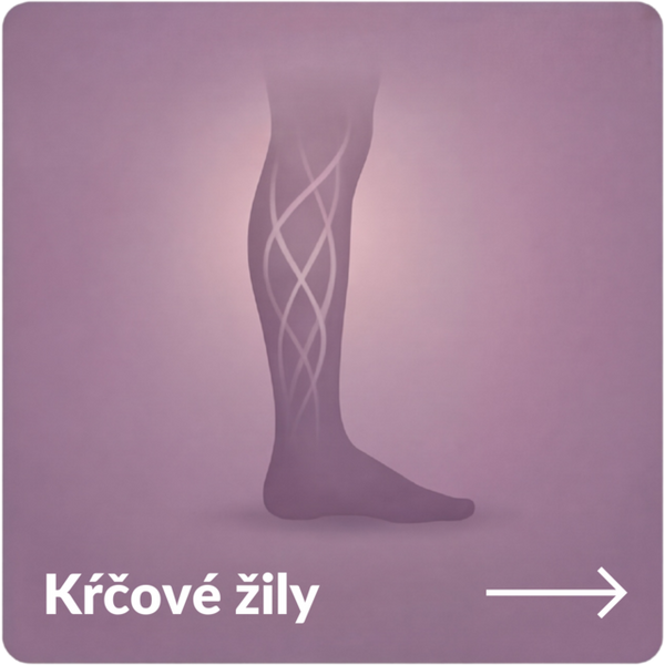Kŕčové žily