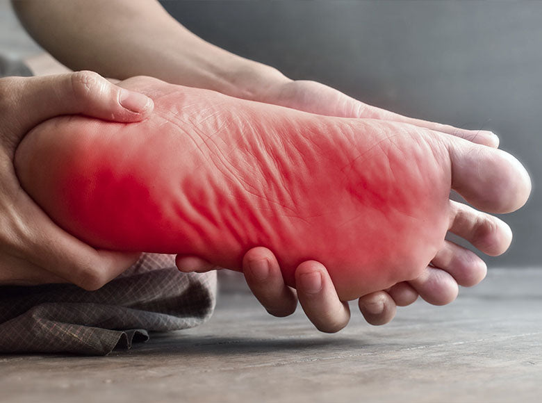 Neuropatická bolesť chodidla