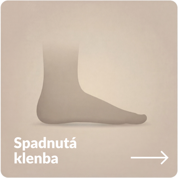 Spadnutá klenba